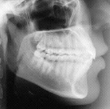 Radiologia Odontológica em Itajaí